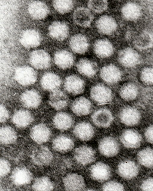 Adeno-associated_viruses