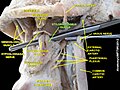 Dissecció. Es veu el múscul estilofaringi.