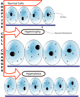 Description de l'image Hyperplasia vs Hypertrophy.svg.