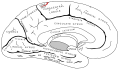 Central sulcus on the medial surface. It divides the paracentral lobule into the anterior part and the posterior part.