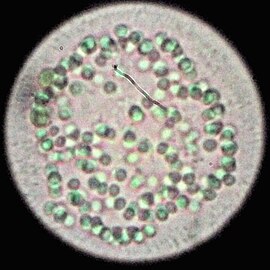 Cyanobacteria Snowella