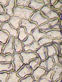 Sel epidermis