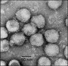 Electron micrograph of negatively stained Nam Dinh virus particles