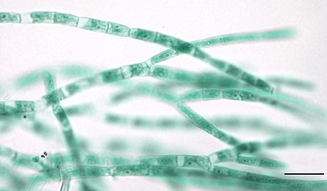 Photomicrograph of multiple strands of Stigeoclonium