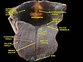 Dissection profonde du plancher buccal. Vue antérieure.