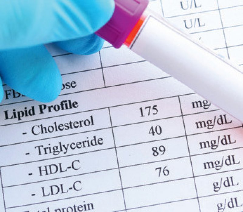 Lipidscreening, Foto: jarun011/stock.adobe.com