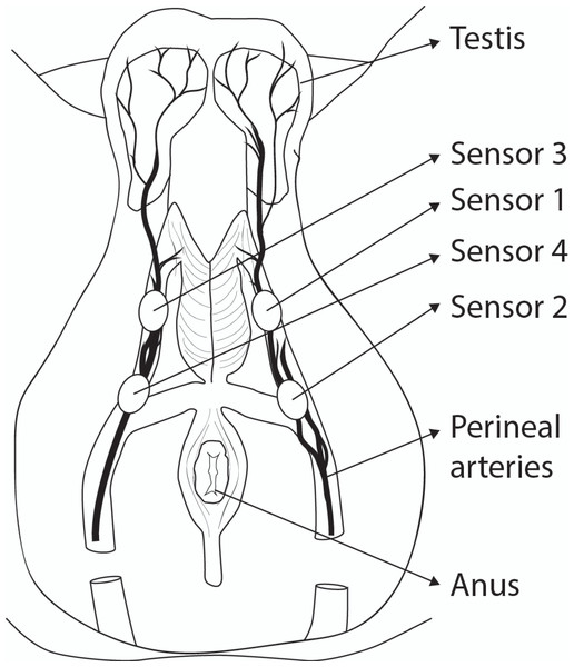 Position of sensors on the Perineum.