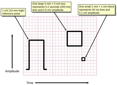 File:ECG Paper v2.svg